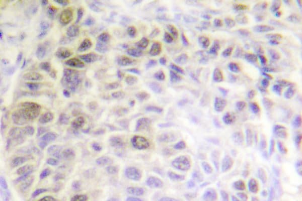 XRCC6 / Ku70 Antibody (Ser1)