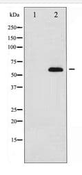 FOXO4 / AFX1 Antibody