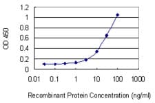 Monoclonal Mouse anti-Human TRPC5 Antibody (clone 1C8, WB)