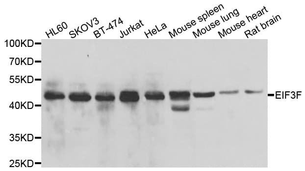 IHC-plus™ EIF3S5 / EIF3F Antibody