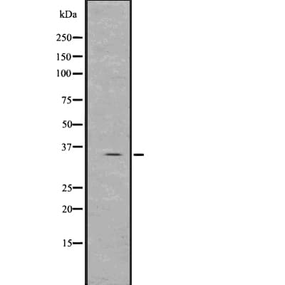 SRM / Spermidine Synthase Antibody