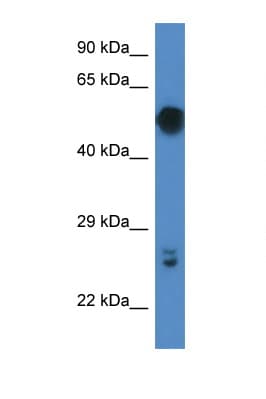 GAL3ST4 Antibody (C-Terminus)