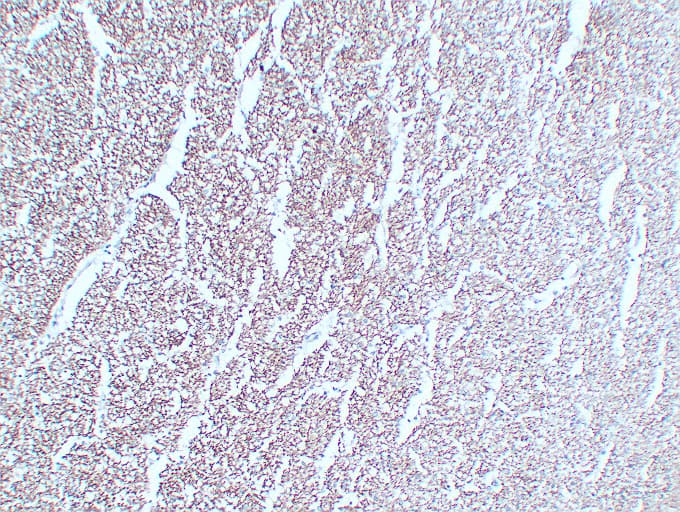 NF-L / NEFL Antibody (clone ABT-NF)