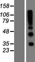 RSPO4 Protein (Over-Expression Lysate Myc-DDK (Flag))