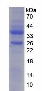 Human YBX1 / YB1 Protein (Recombinant His, N-Terminal)