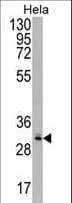 CRYZL1 Antibody (aa296-323)