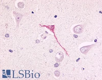 PathPlus™ Polyclonal Rabbit anti-Human GPR17 Antibody (N-Terminus, IHC)