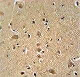WIPF2 / WIRE Antibody (aa392-419)