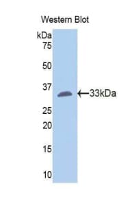 FGG / Fibrinogen Gamma Antibody (aa170-429)
