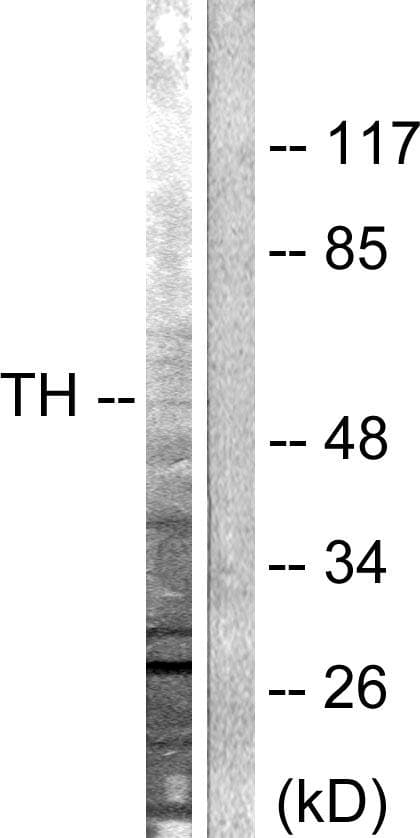 TH / Tyrosine Hydroxylase Antibody (p19)