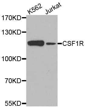 CSF1R / CD115 / FMS Antibody