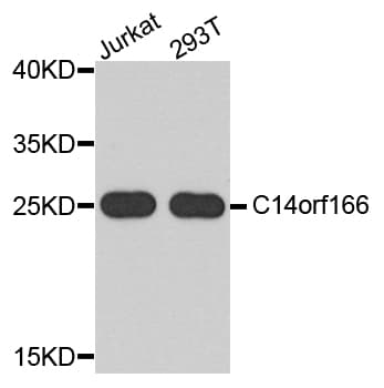 Polyclonal Rabbit anti-Human C14orf166 Antibody (IHC, WB)