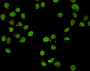 CHD3 Antibody