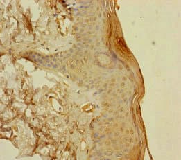 BCMP84 / S100A14 Antibody