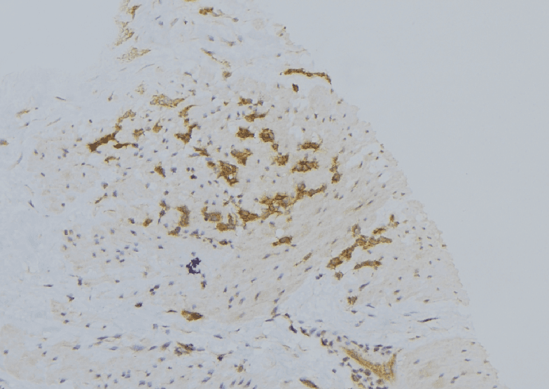 VPS33B Antibody