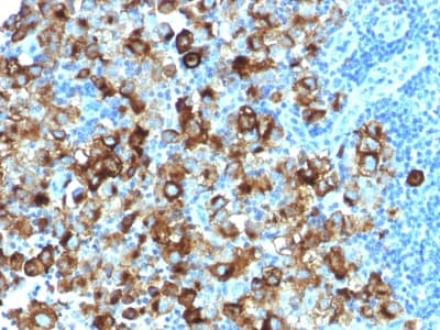 PMEL / SILV / gp100 Antibody (clone PMEL/1825R, Azide-free, Carrier-free)