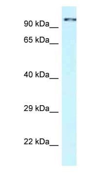 Polyclonal Rabbit anti-Human CDK11A / CDC2L2 Antibody (aa696-745, WB)