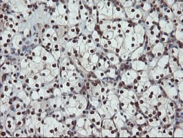 UBE2E3 Antibody (clone OTI7E8)