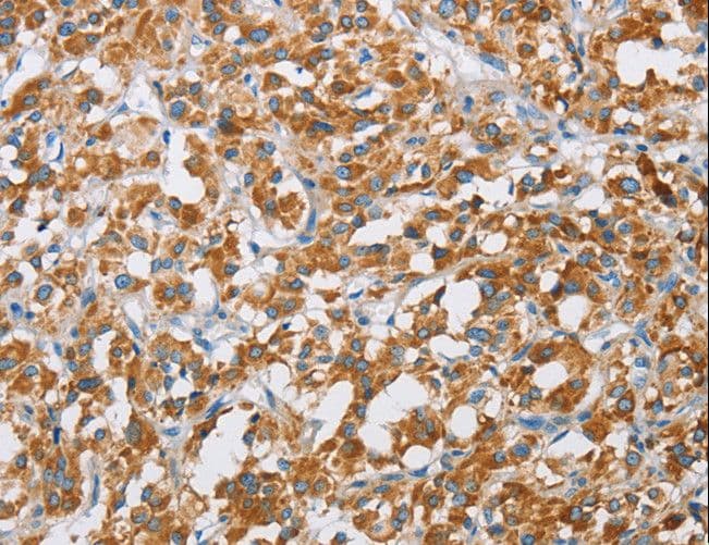 SDR9C1 / BDH1 Antibody