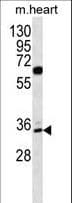 Polyclonal Rabbit anti-Human ZNF146 Antibody (aa17-45, WB)