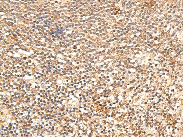 Polyclonal Rabbit anti-Human TRAPPC1 / MUM2 Antibody (IHC)