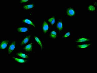Polyclonal Rabbit anti-Human FHL2 Antibody (IHC, IF)