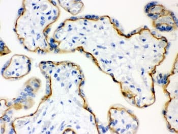 CDH1 / E Cadherin Antibody