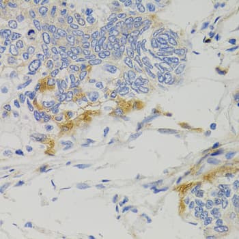 PTPN11 / SHP-2 / NS1 Antibody