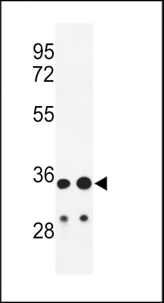 IGHA1 / IgA1 Antibody (aa 290-320, C-Term)