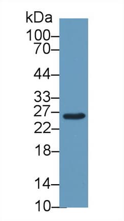 GSTM2 Antibody (aa5-202, APC)