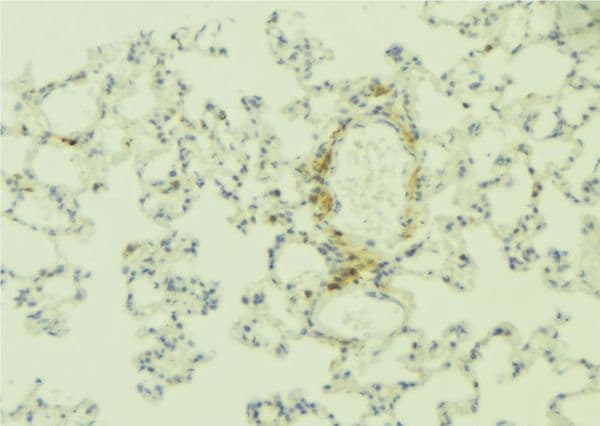 ITGB4 / Integrin Beta 4 Antibody