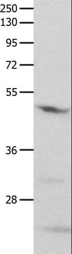 Polyclonal Rabbit anti-Human GNAS Antibody (IHC, WB)