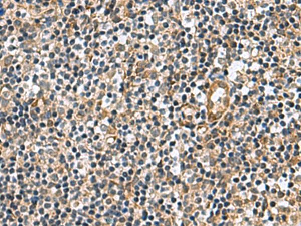 TGM3 / Transglutaminase 3 Antibody