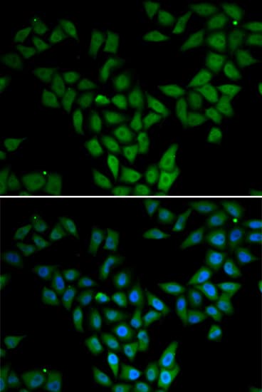 ASF1A Antibody