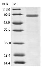 Human PDE4DIP / MMGL Protein (Recombinant GST, N-terminus)