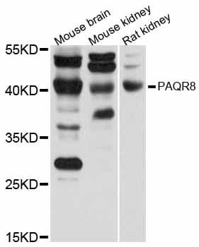 LMPB1 / PAQR8 Antibody