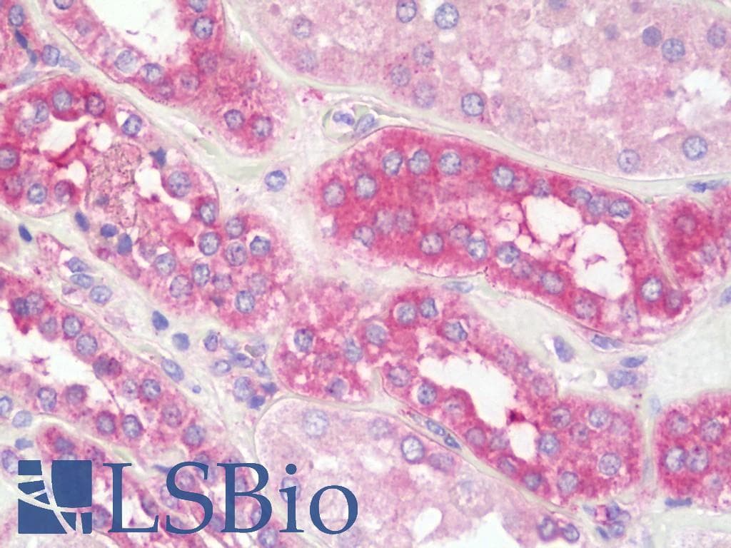 IHC-plus™ Polyclonal Rabbit anti-Human EEA1 Antibody (IHC, WB)