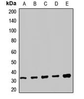 TRMT61A / TRM61 Antibody