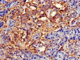 Polyclonal Rabbit anti-Human TNFAIP1 Antibody (IHC, IF)