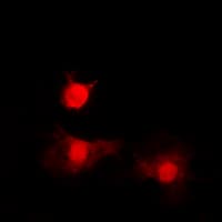 HDAC8 Antibody (phospho-Ser39)