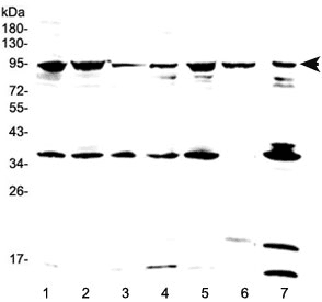 FES Antibody