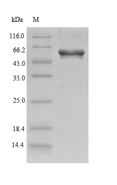 Xenopus laevis gata1a Protein (Recombinant 10His-SUMO, N-terminus + Myc, C-terminus)