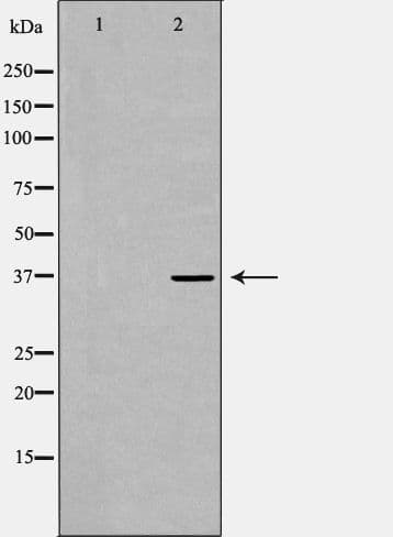 RNF2 / RING2 / RING1B Antibody