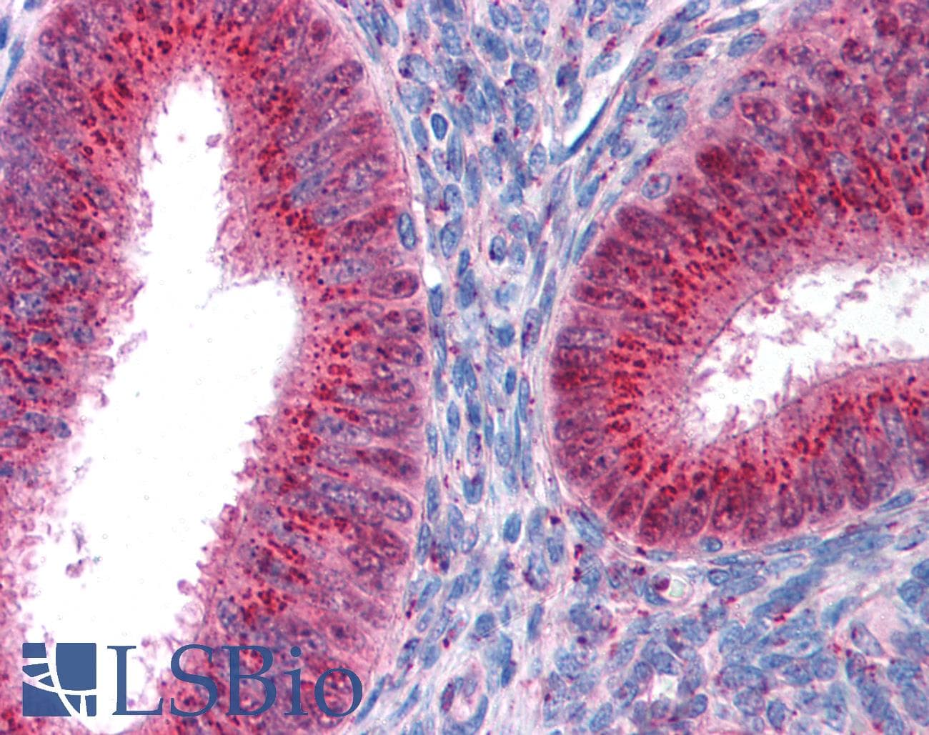 Polyclonal Rabbit anti-Human FOXA1 Antibody (aa395-444, IHC, WB)