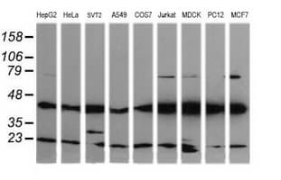 MAP2K1 / MKK1 / MEK1 Antibody (clone OTI3H3)