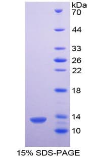 Mouse CXCL4 / PF4 Protein (Recombinant His)