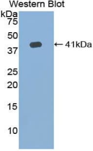 HFE2 / Hemojuvelin Antibody (aa41-386)