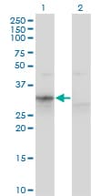 Monoclonal Mouse anti-Human APOF / Apolipoprotein F Antibody (clone 1D5, WB)