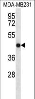 TMEM43 Antibody (aa195-223)