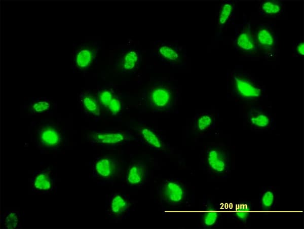 Monoclonal Mouse anti-Human MAP2K6 / MEK6 / MKK6 Antibody (clone 2F2, IF, WB)